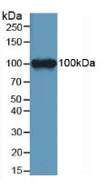 Polyclonal Antibody to Leptin Receptor (LEPR)