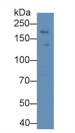 Polyclonal Antibody to Leptin Receptor (LEPR)