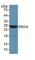 Polyclonal Antibody to Leptin (LEP)