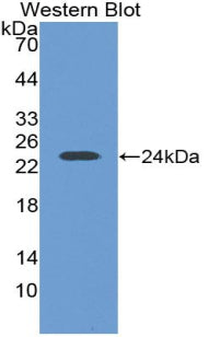 Polyclonal Antibody to Leukemia Inhibitory Factor (LIF)