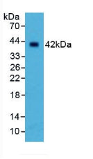 Polyclonal Antibody to Selectin, Leukocyte (SELL)