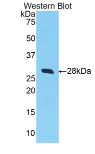 Polyclonal Antibody to Selectin, Leukocyte (SELL)