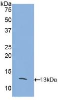 Polyclonal Antibody to Monocyte Chemotactic Protein 2 (MCP2)