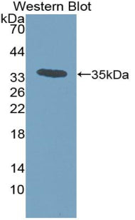 Polyclonal Antibody to Monocyte Chemotactic Protein 3 (MCP3)