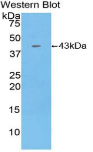 Polyclonal Antibody to Macrophage Inflammatory Protein 1 Beta (MIP1b)