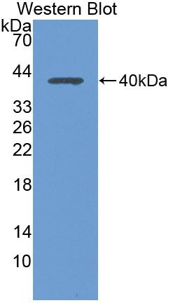 Polyclonal Antibody to Macrophage Inflammatory Protein 1 Beta (MIP1b)