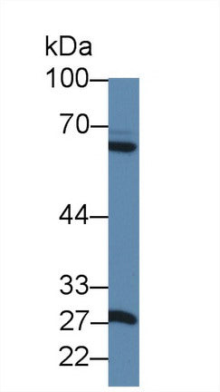 Polyclonal Antibody to Matrix Metalloproteinase 1 (MMP1)