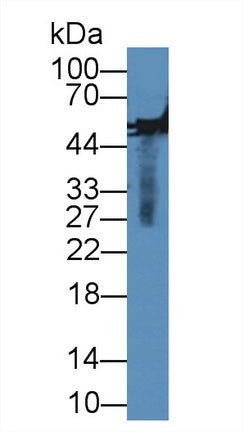 Polyclonal Antibody to Matrix Metalloproteinase 13 (MMP13)