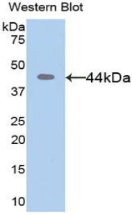 Polyclonal Antibody to Matrix Metalloproteinase 8 (MMP8)