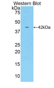 Polyclonal Antibody to Creatine Kinase, Muscle (CKM)