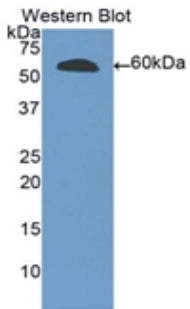 Polyclonal Antibody to Ribonuclease T2 (RNASET2)