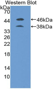 Polyclonal Antibody to Placenta Growth Factor (PLGF)