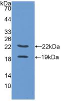 Polyclonal Antibody to Placenta Growth Factor (PLGF)