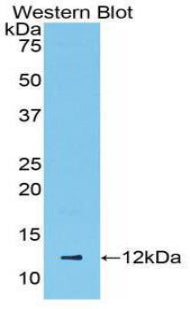 Polyclonal Antibody to Regulated On Activation In Normal T-Cell Expressed And Secreted (RANTES)