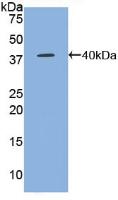 Polyclonal Antibody to Regulated On Activation In Normal T-Cell Expressed And Secreted (RANTES)