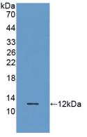 Polyclonal Antibody to Regulated On Activation In Normal T-Cell Expressed And Secreted (RANTES)