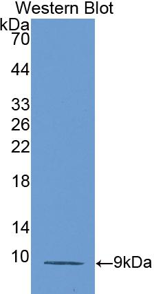 Polyclonal Antibody to Regulated On Activation In Normal T-Cell Expressed And Secreted (RANTES)