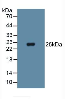 Polyclonal Antibody to Superoxide Dismutase 3, Extracellular (SOD3)