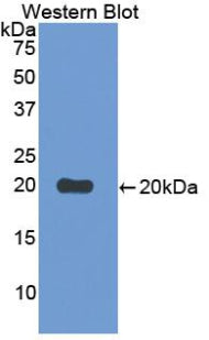 Polyclonal Antibody to Cluster Of Differentiation 30 Ligand (CD30L)