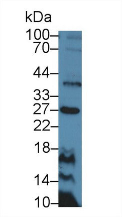 Polyclonal Antibody to Cluster Of Differentiation 30 Ligand (CD30L)