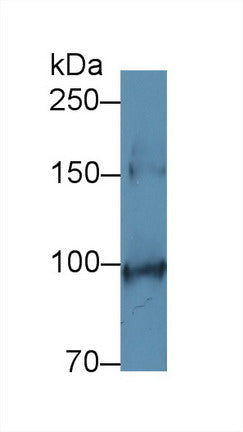 Polyclonal Antibody to Stem Cell Factor Receptor (SCFR)