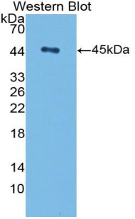 Polyclonal Antibody to Transforming Growth Factor Beta 1 (TGFb1)