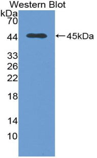 Polyclonal Antibody to Transforming Growth Factor Beta 1 (TGFb1)