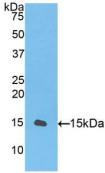 Polyclonal Antibody to Transforming Growth Factor Beta 1 (TGFb1)