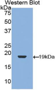 Polyclonal Antibody to Transforming Growth Factor Beta 1 (TGFb1)