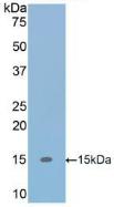 Polyclonal Antibody to Transforming Growth Factor Beta 1 (TGFb1)