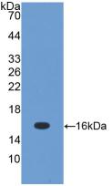 Polyclonal Antibody to Transforming Growth Factor Beta 1 (TGFb1)