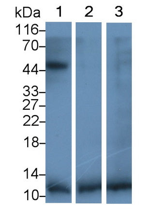 Polyclonal Antibody to Transforming Growth Factor Beta 1 (TGFb1)