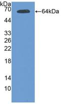 Polyclonal Antibody to TEK Tyrosine Kinase, Endothelial (Tie2)