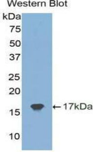 Polyclonal Antibody to Tissue Inhibitors Of Metalloproteinase 2 (TIMP2)