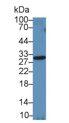 Polyclonal Antibody to Tissue Inhibitors Of Metalloproteinase 2 (TIMP2)