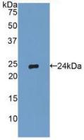 Polyclonal Antibody to Tissue Inhibitors Of Metalloproteinase 2 (TIMP2)