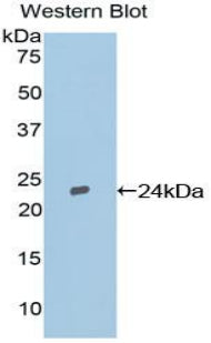 Polyclonal Antibody to Tissue Inhibitors Of Metalloproteinase 2 (TIMP2)