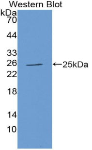 Polyclonal Antibody to Tissue Inhibitors Of Metalloproteinase 3 (TIMP3)