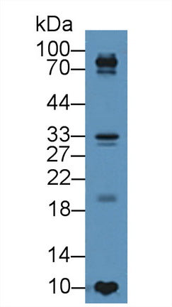 Polyclonal Antibody to Tissue Inhibitors Of Metalloproteinase 4 (TIMP4)