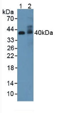 Polyclonal Antibody to Adiponectin Receptor 2 (ADIPOR2)