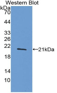 Polyclonal Antibody to Tumor Necrosis Factor Alpha (TNFa)