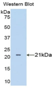 Polyclonal Antibody to Tumor Necrosis Factor Alpha (TNFa)