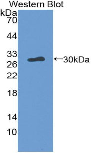 Polyclonal Antibody to Thrombopoietin (TPO)