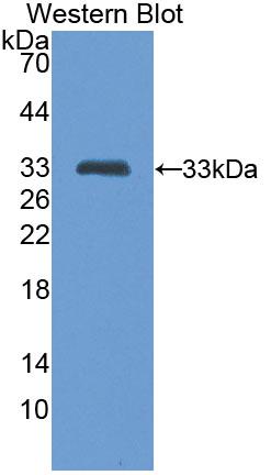 Polyclonal Antibody to Tumor Necrosis Factor Related Apoptosis Inducing Ligand (TRAIL)