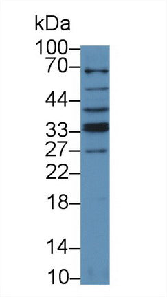 Polyclonal Antibody to Tumor Necrosis Factor Related Apoptosis Inducing Ligand (TRAIL)