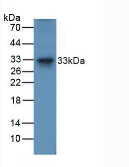 Polyclonal Antibody to Tumor Necrosis Factor Related Apoptosis Inducing Ligand (TRAIL)