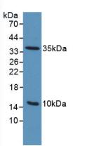 Polyclonal Antibody to Plasminogen Activator, Urokinase Receptor (uPAR)