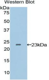 Polyclonal Antibody to Vascular Endothelial Growth Factor B (VEGFB)