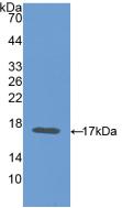 Polyclonal Antibody to Carcinoembryonic Antigen (CEA)