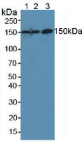 Polyclonal Antibody to Carcinoembryonic Antigen (CEA)